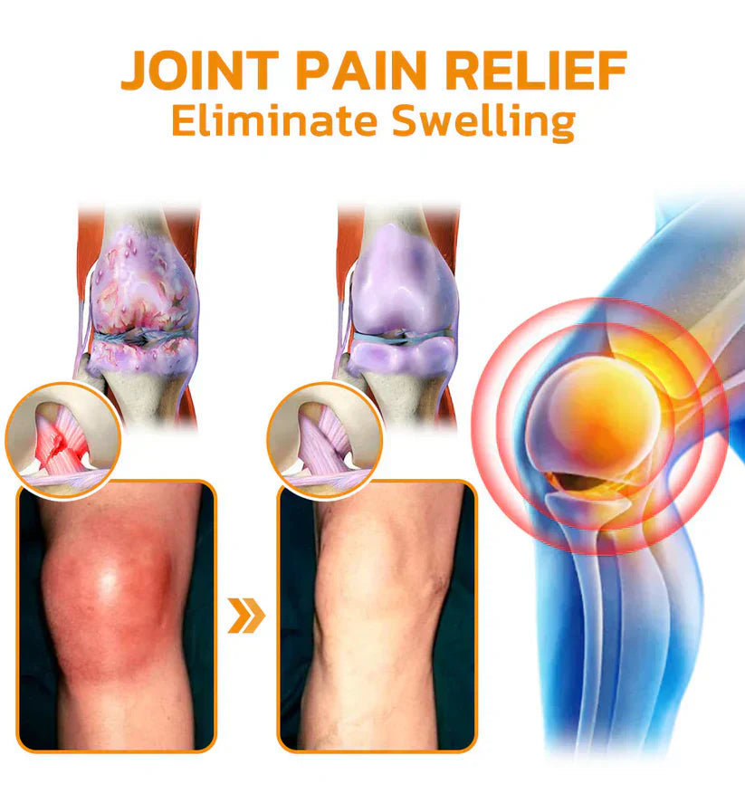 Pryxo Bee poison Pain ArthritisTherapy Cream (specially forolder adults & AAOSrecommends)