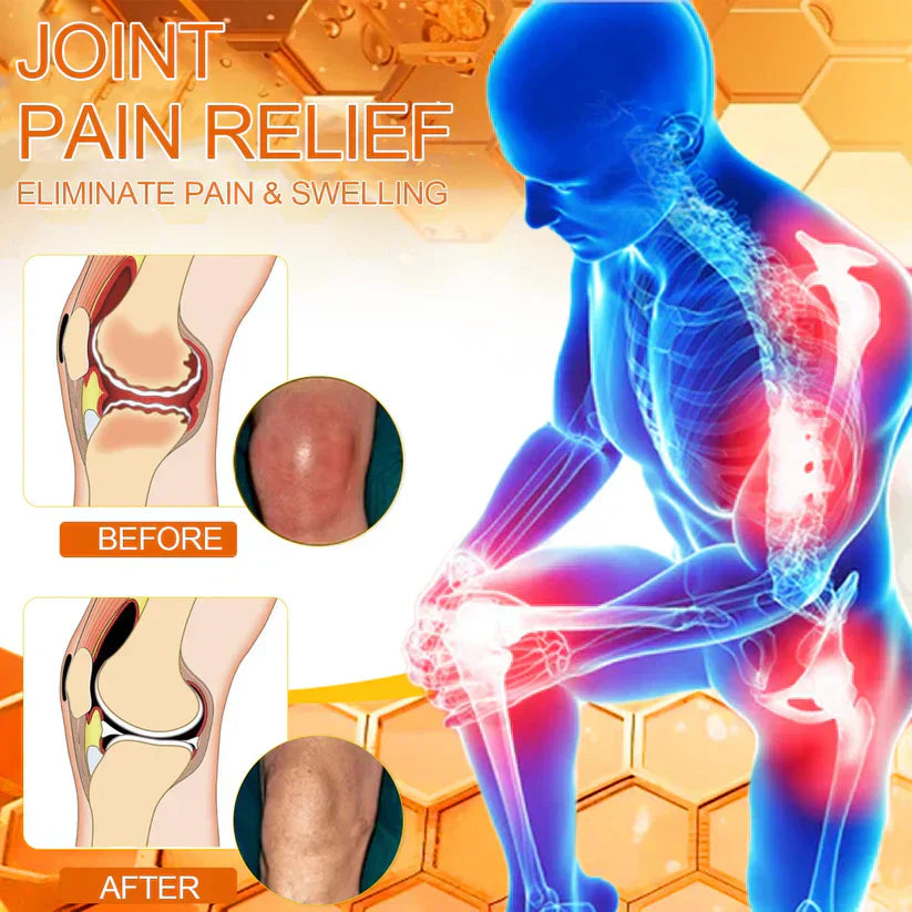 Pryxo Bee poison Pain ArthritisTherapy Cream (specially forolder adults & AAOSrecommends)