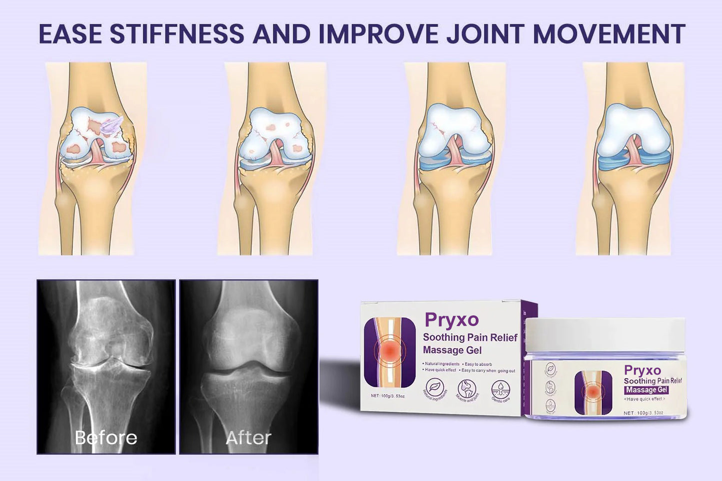 Pryxo™ Natural Relief – Restore Mobility with Turmeric & Emu Oil