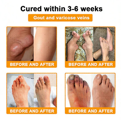 🏆50K+ SOLD LAST WEEK! 🌿LUMIVO™Bee Poison Pain-Relief Bone Healing Cream
