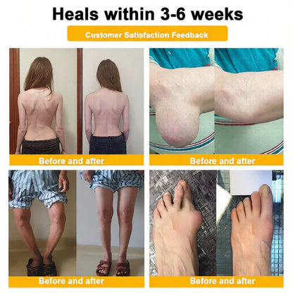 🏆50K+ SOLD LAST WEEK! 🌿LUMIVO™Bee Poison Pain-Relief Bone Healing Cream