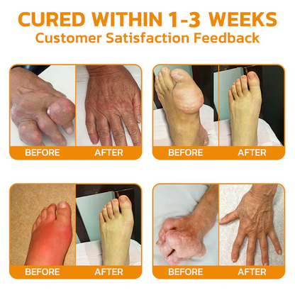 Pryxo Bee poison Pain ArthritisTherapy Cream (specially forolder adults & AAOSrecommends)