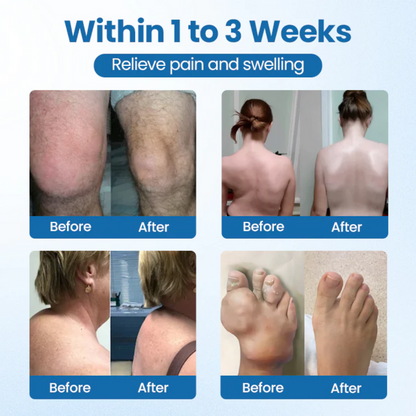 🚀 98.5% RECOMMEND! Deep-Penetrating Muscle Balm – Fast Relief for Arthritis, Back & Knee Pain-8CR5