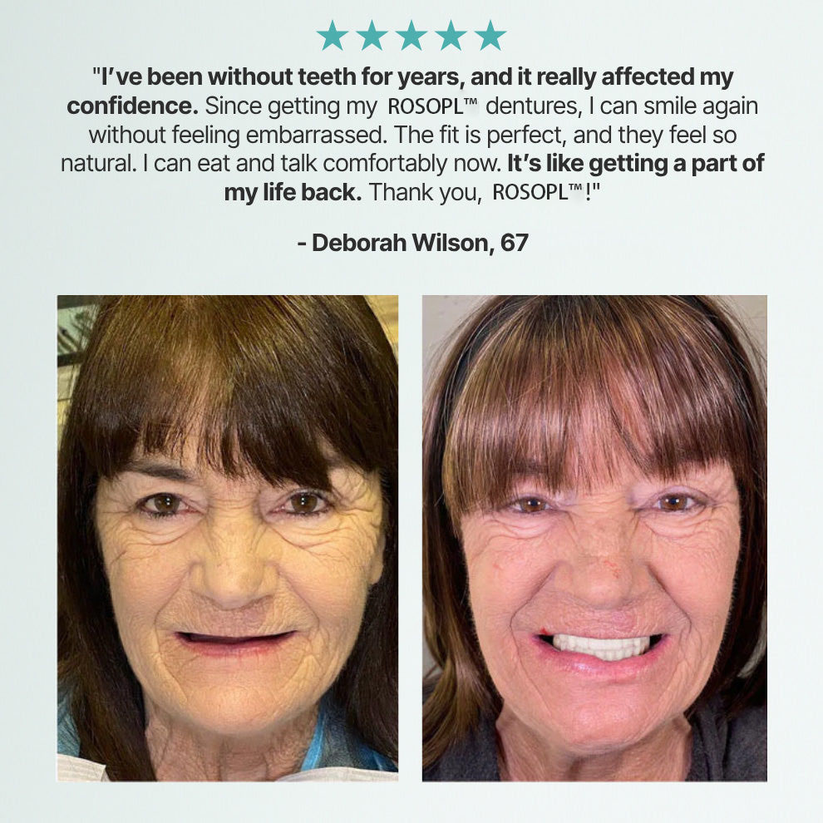Facebook review: 'Amazing. They are so comfortable and looks like my natural teeth'